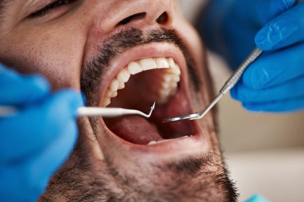 Best Emergency Wisdom Teeth Removal in Collingdale, PA